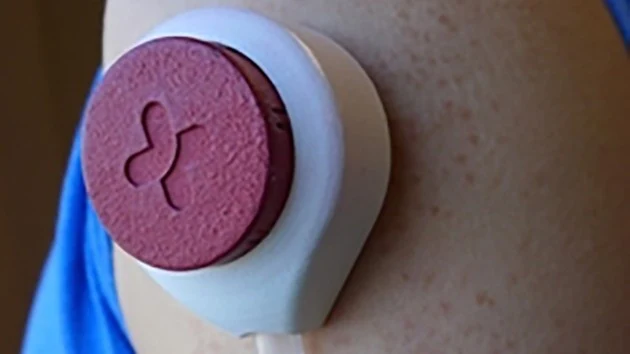 Już niedługo krew będzie pobierana przy pomocy takich urządzeń /fot. Tasso Inc. Już niedługo krew będzie pobierana przy pomocy takich urządzeń /fot. Tasso Inc.