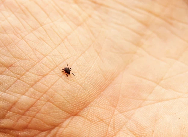 Borelioza to choroba roznoszona przez kleszcze, a wywoływana przez bakterię krętka boreliozy Borelioza to choroba roznoszona przez kleszcze, a wywoływana przez bakterię krętka boreliozy