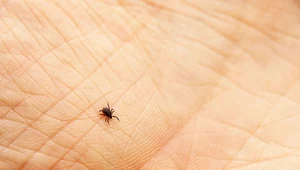 Borelioza to choroba roznoszona przez kleszcze, a wywoływana przez bakterię krętka boreliozy