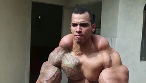 Chciał być ogromny. Przez synthol omal nie stracił rąk