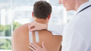 Nie obawiaj się testów skórnych. Wbrew pozorom badanie to nie jest bolesne. W ten sposób testuje się ponad 100 alergenów