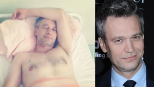 Michał Żebrowski po operacji