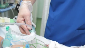 Zależnie od przyczyny niedrożności dróg przeprowadza się tracheotomię odpowiedniego rodzaju