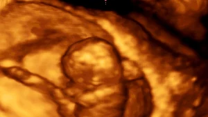 Obraz USG - trzymiesięczne dziecko w łonie matki