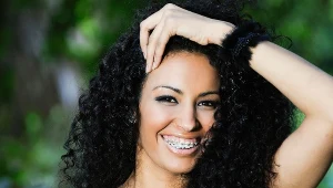 Aparaty ortodontyczne przestały być czymś wstydliwym