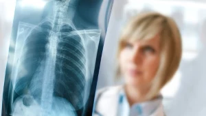 Początkowym objawem rozedmy płuc są duszności