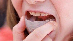 W większości wad zgryzu stosuje się leczenie ortodontyczne