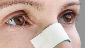 Idealnie prosta przegroda nosowa to rzadkość