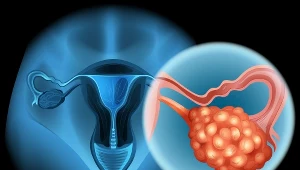 Rak narządów rodnych to wciąż temat tabu
