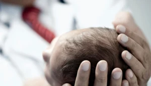 Powiększenie obwodu głowy to tylko jeden z wielu objawów wodogłowia