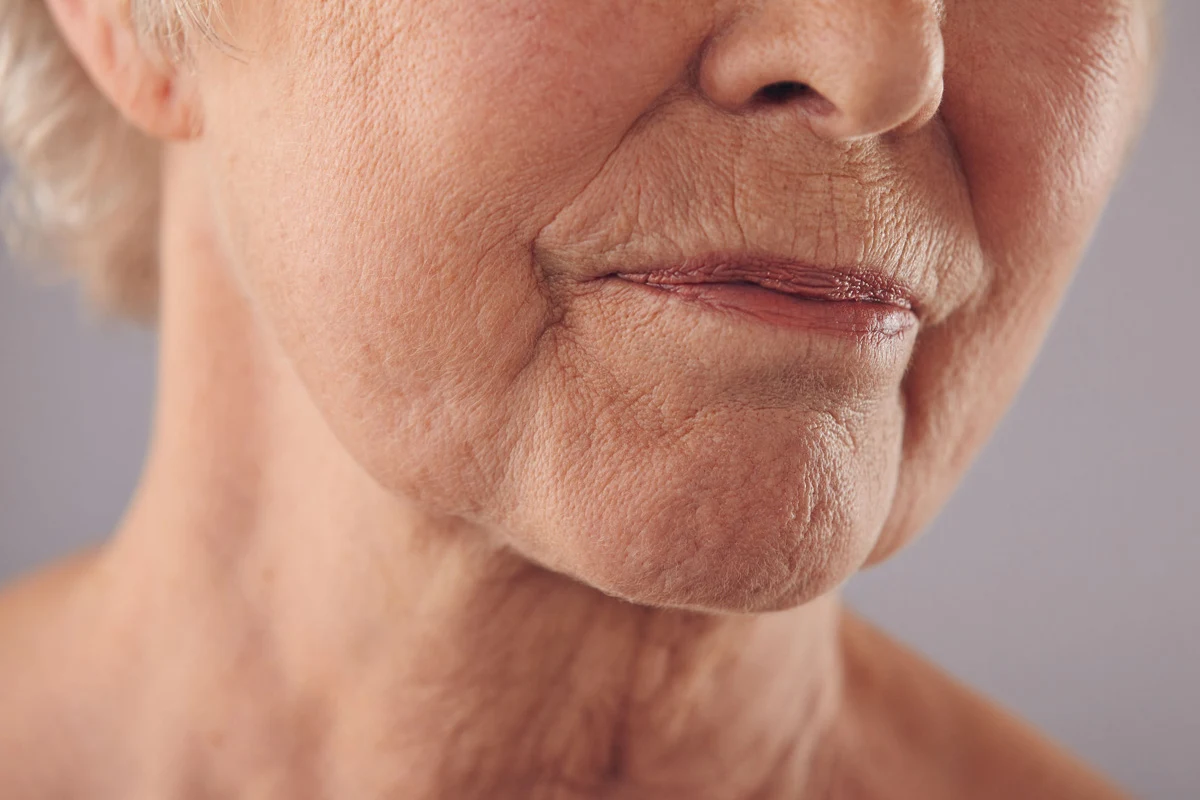 Warto zapobiegać powstawaniu zmarszczek, zanim będzie za późno