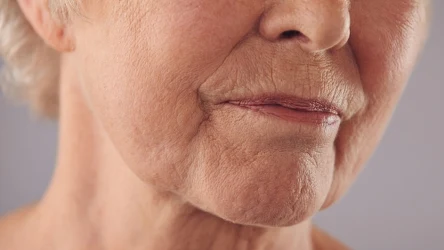 Jak poradzić sobie ze zmarszczkami wokół ust?
