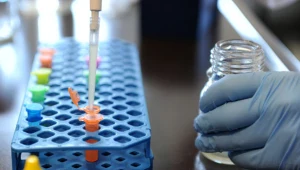 Do zanieczyszczenia mikrobiologicznego wtórnego doszło u jednego z odbiorców (zdjęcie ilustracyjne)