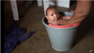 Wirus Zika powoduje małogłowie u niemowląt