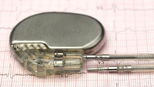 Rozrusznik serca (kardiostymulator, symulator serca) to niewielkie urządzenie, którego działanie polega na elektrycznym pobudzaniu serca