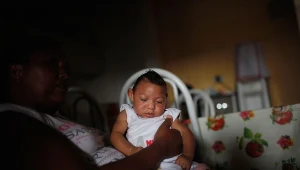 Niemowlęta zakażona wirusem Zika są narażone na mikrocefalię