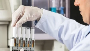 Żółkną ci gałki oczne i skóra? Reaguj, nim będzie za późno