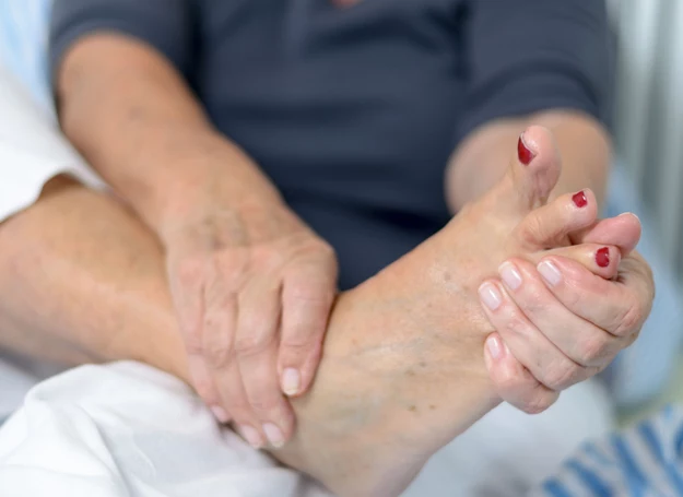 Gdy już pojawił się obrzęk i ból palucha, przygotuj łagodzący okład z pasty borowinowej Gdy już pojawił się obrzęk i ból palucha, przygotuj łagodzący okład z pasty borowinowej
