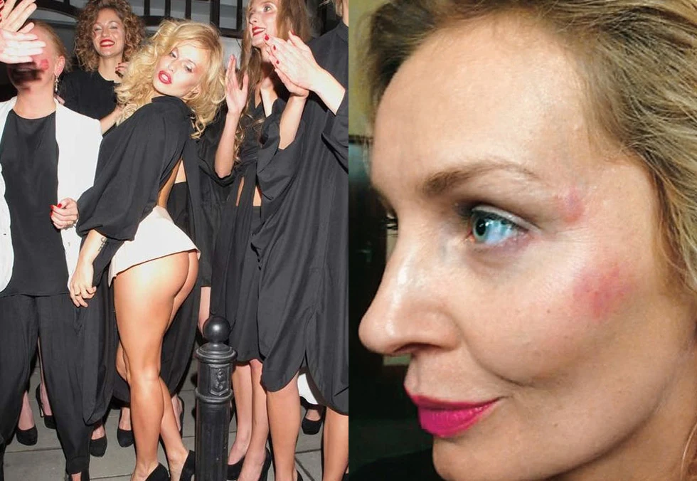 Doda i pobita Agnieszka Szulim Doda i pobita Agnieszka Szulim