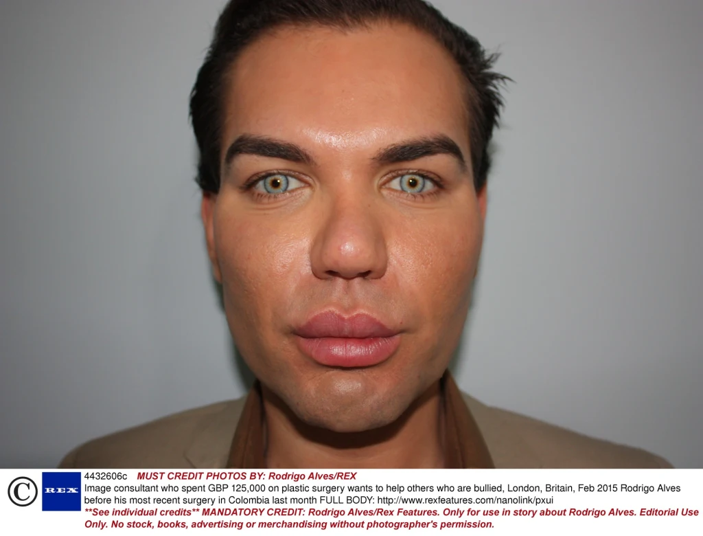 Rodrigo Alves Rodrigo Alves