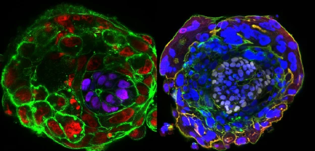 Epiblast - po lewej na fioletowo, po prawej na fioletowo-biało /fot. University of Cambridge