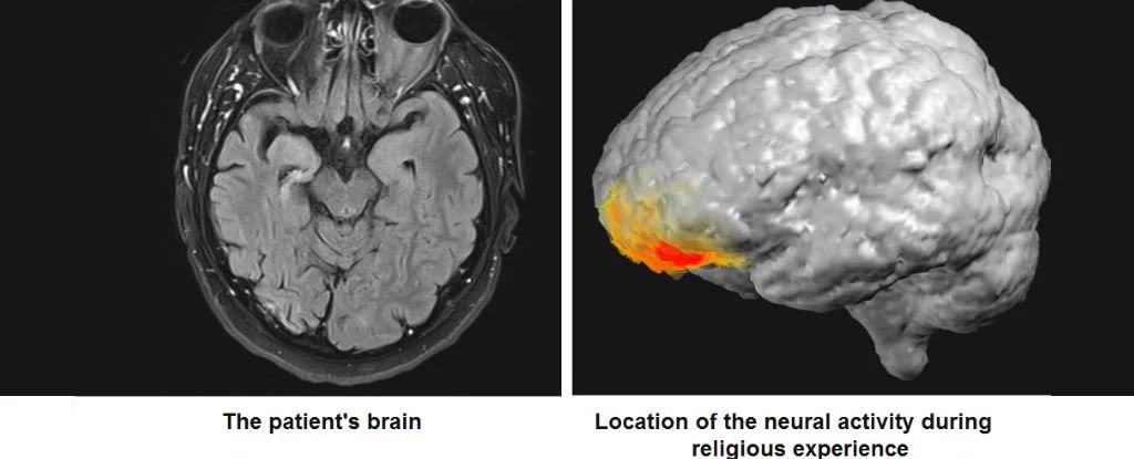 Aktywność mózgowa podczas religijnych doświadczeń