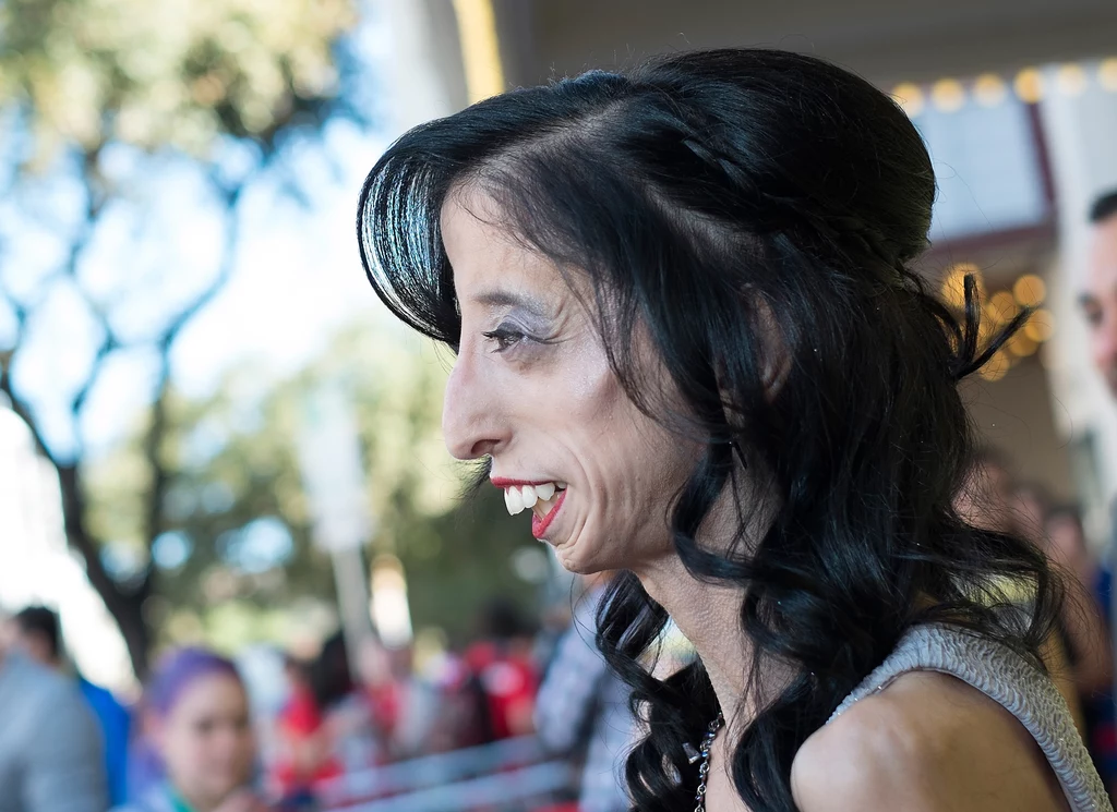 Lizzie Velasquez