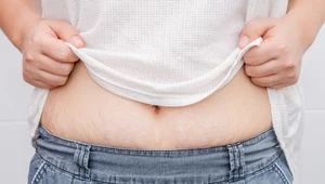 Na pojawienie się rozstępów, podobnie jak w przypadku cellulitu, narażona jest większość kobiet