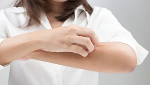 W ślinie muchówek znajdują się substancje drażniące, które mogą wywołać stan zapalny