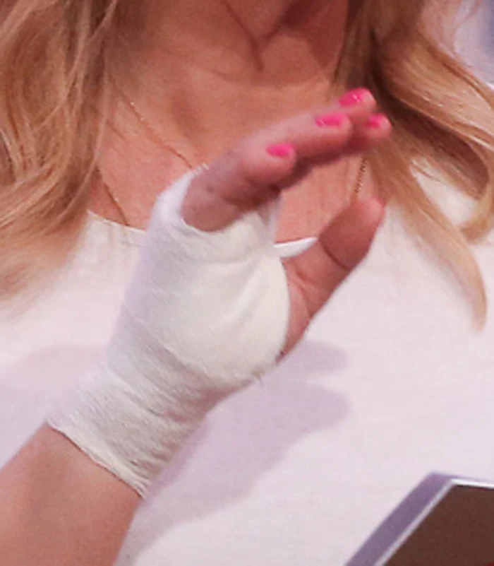 Ręka przebita gwoźdzem