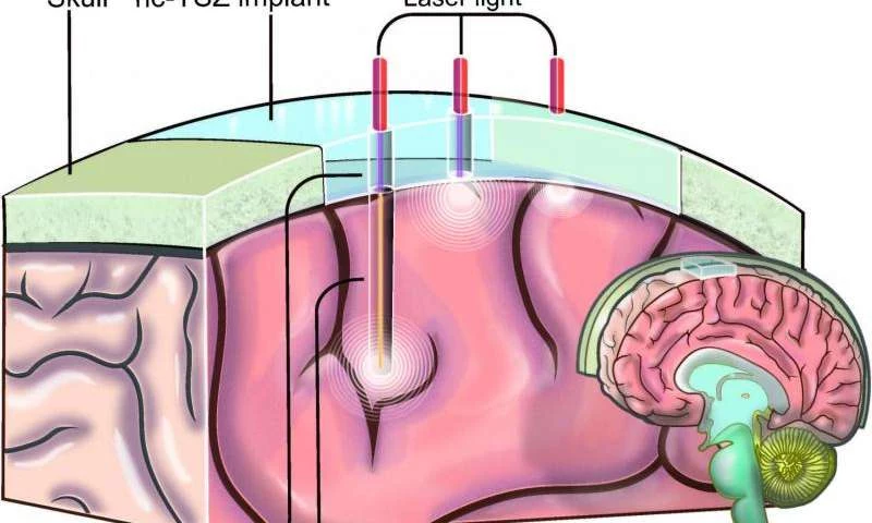 Takie "okna na mózg" pozwolą zwiększyć skuteczność współczesnych neuroterapii?