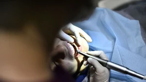 Statystki dotyczące uzebienia Polaków są fatalne