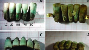 Proteza znaleziona w grobowcu rodziny Giunigi