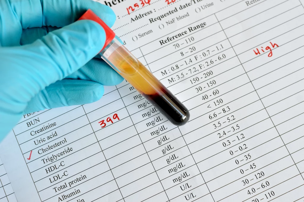 Hipercholesterolemia to najczęstsze schorzenie dziedziczne - może dotknąć co 2. osobę w rodzinie.