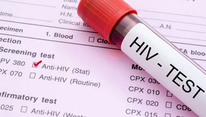 HIV - wirus groźniejszy niż SARS-CoV-2