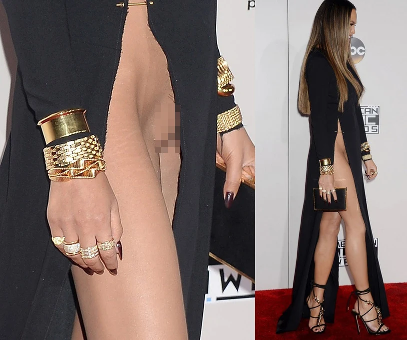 Chrissy Teigen  Chrissy Teigen