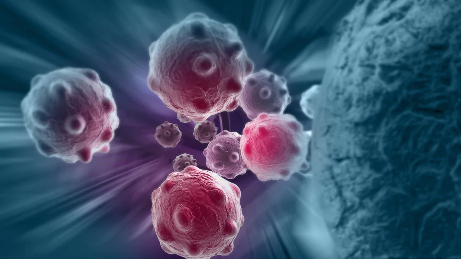 Nowy rodzaj immunoterapii "wymazuje" raka kości w trzy miesiące Nowy rodzaj immunoterapii "wymazuje" raka kości w trzy miesiące