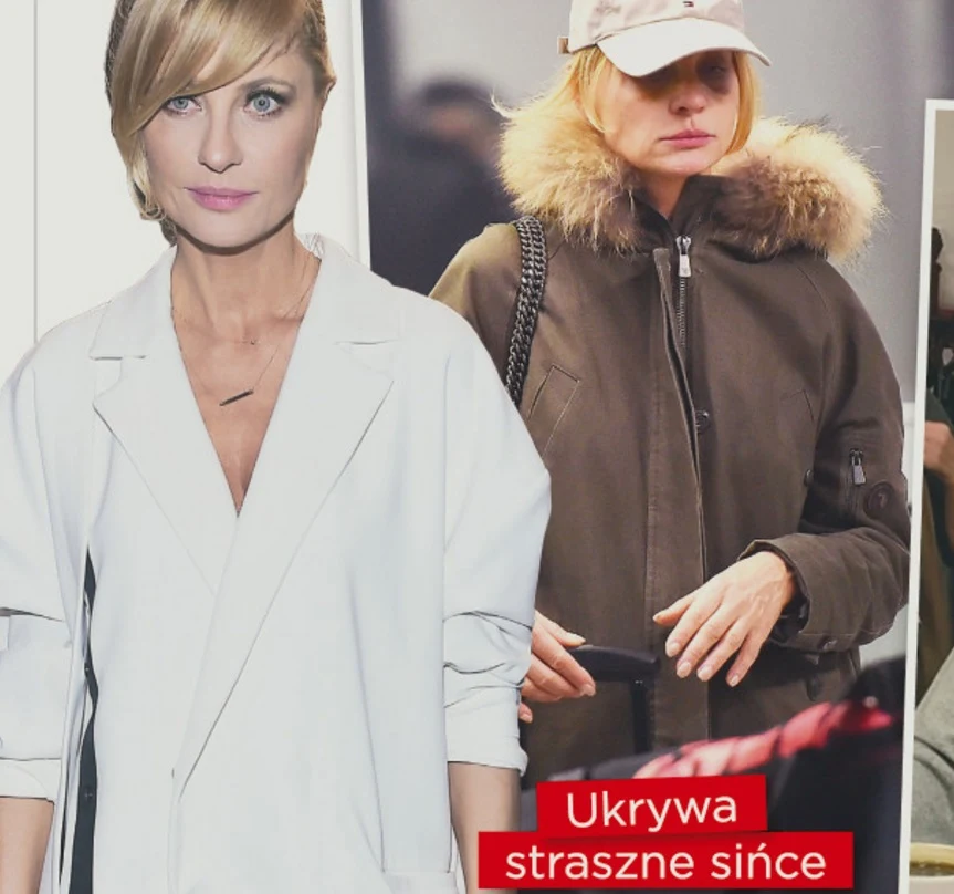 Aneta z siniakami na lotnisku! (Źródło: Show) Aneta z siniakami na lotnisku! (Źródło: Show)