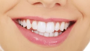 4 naturalne sposoby na piękne zęby