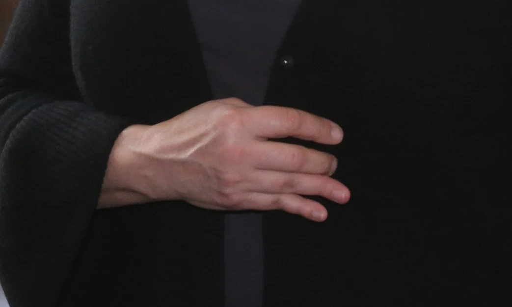 Ostatnio ręka zaczęła mocno doskwierać Kasi Ostatnio ręka zaczęła mocno doskwierać Kasi