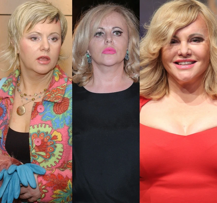 Joanna Kurowska nie stosuje żadnych zabiegów! Joanna Kurowska nie stosuje żadnych zabiegów!