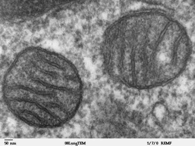 W mitochondriach może być nawet o 10 stopni Celsjusza cieplej, niż w innych częściach ciała