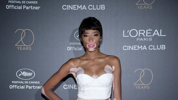 Winnie Harlow 