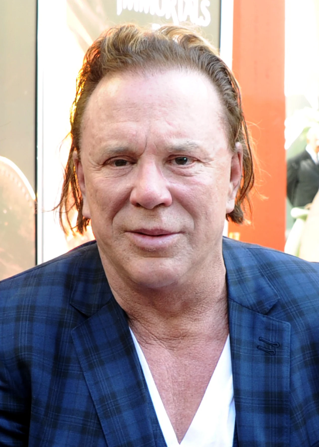 Uprawiając boks, Mickey Rourke kilka razy złamał nos. W latach 90. zaczął też pić. Niekorzystne zmiany próbuje tuszować przy pomocy skalpela.