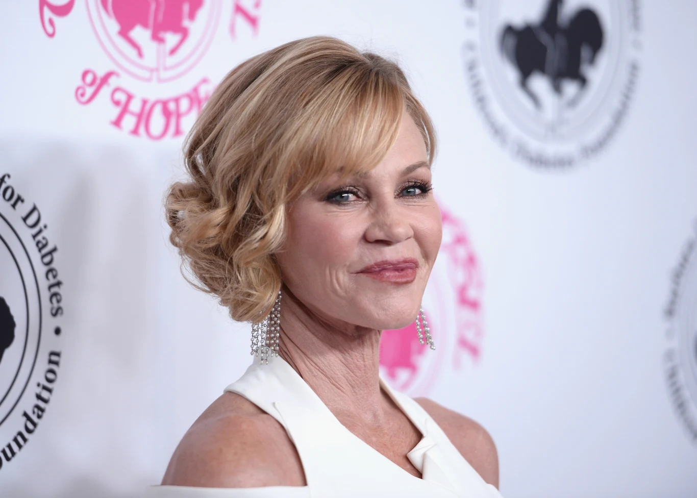 Melanie Griffith, była żona Antonio Banderasa, uważa, że padła ofiarą własnej głupoty. Po zabiegach przestała istnieć jako aktorka.
