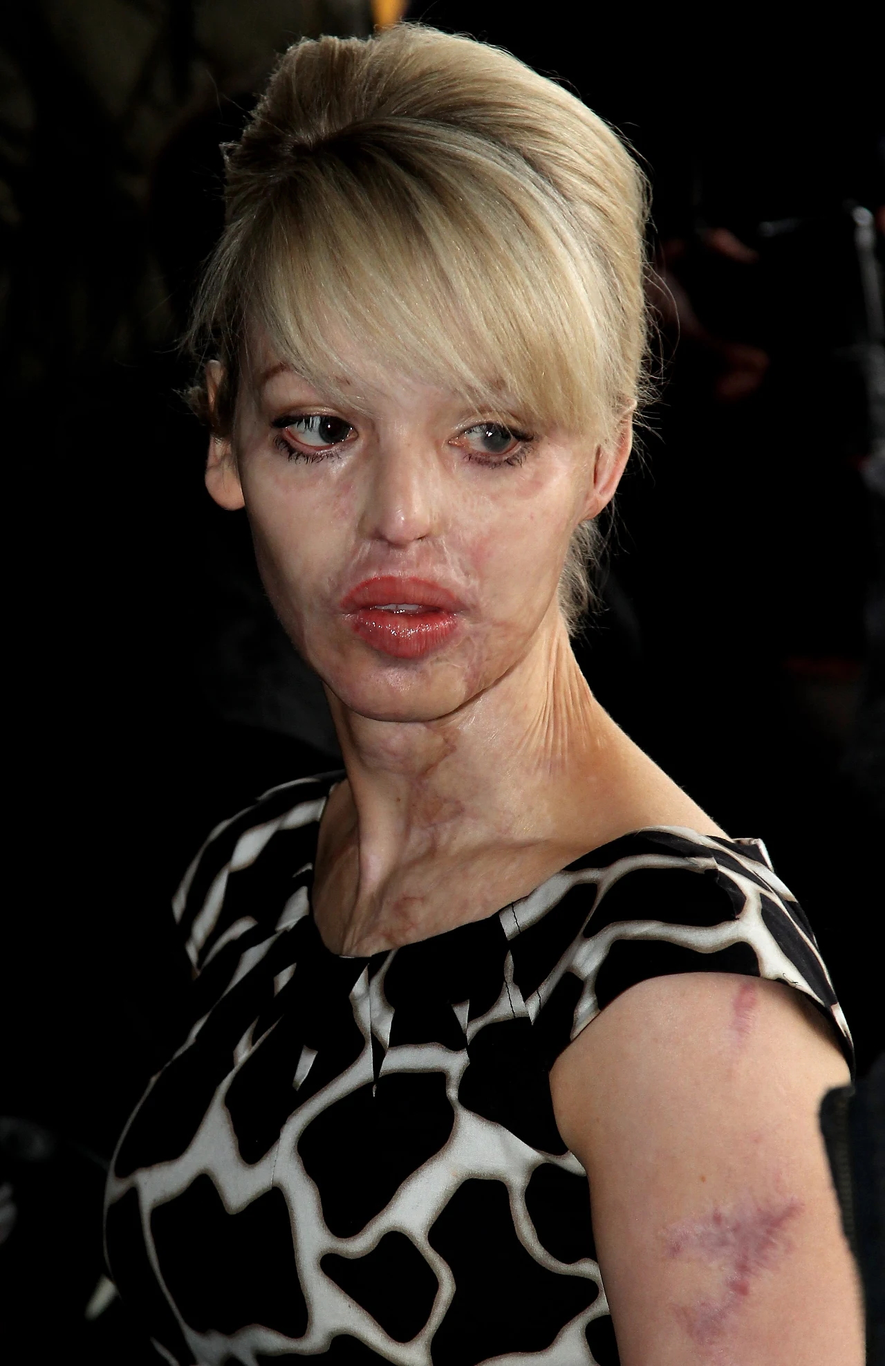 Modelka przeszła kilkadzisiąt operacji; zdj. z 2010 roku