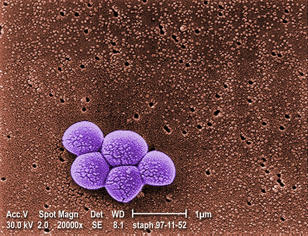 MRSA pod mikroskopem SEM