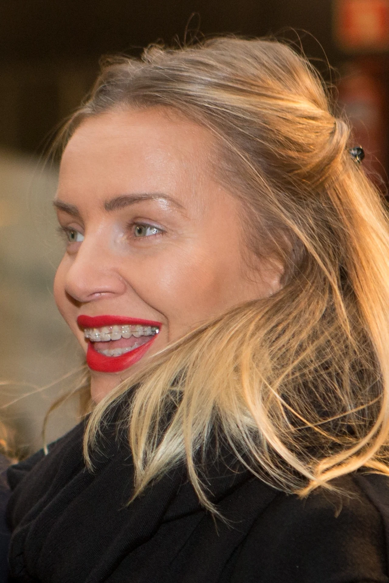 Agnieszka Szulim-Badziak-Woźniak-Starak niedawno zdecydował się na aparat Agnieszka Szulim-Badziak-Woźniak-Starak niedawno zdecydował się na aparat