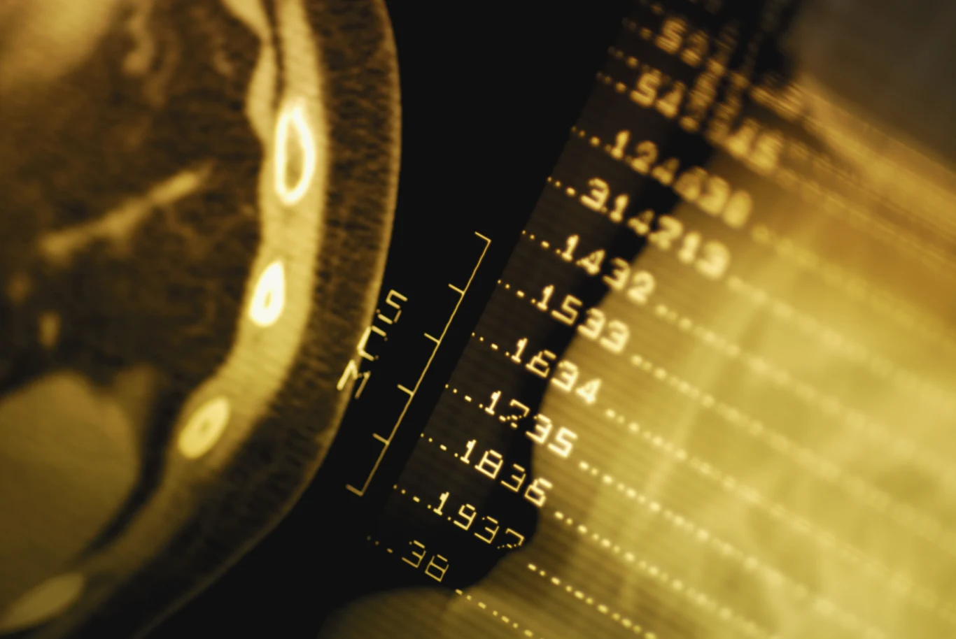 Jesteśmy coraz bliżej pokonania choroby Huntingtona Jesteśmy coraz bliżej pokonania choroby Huntingtona