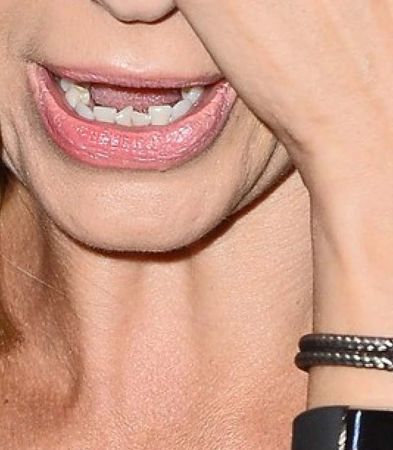 Zęby Szulim  Zęby Szulim